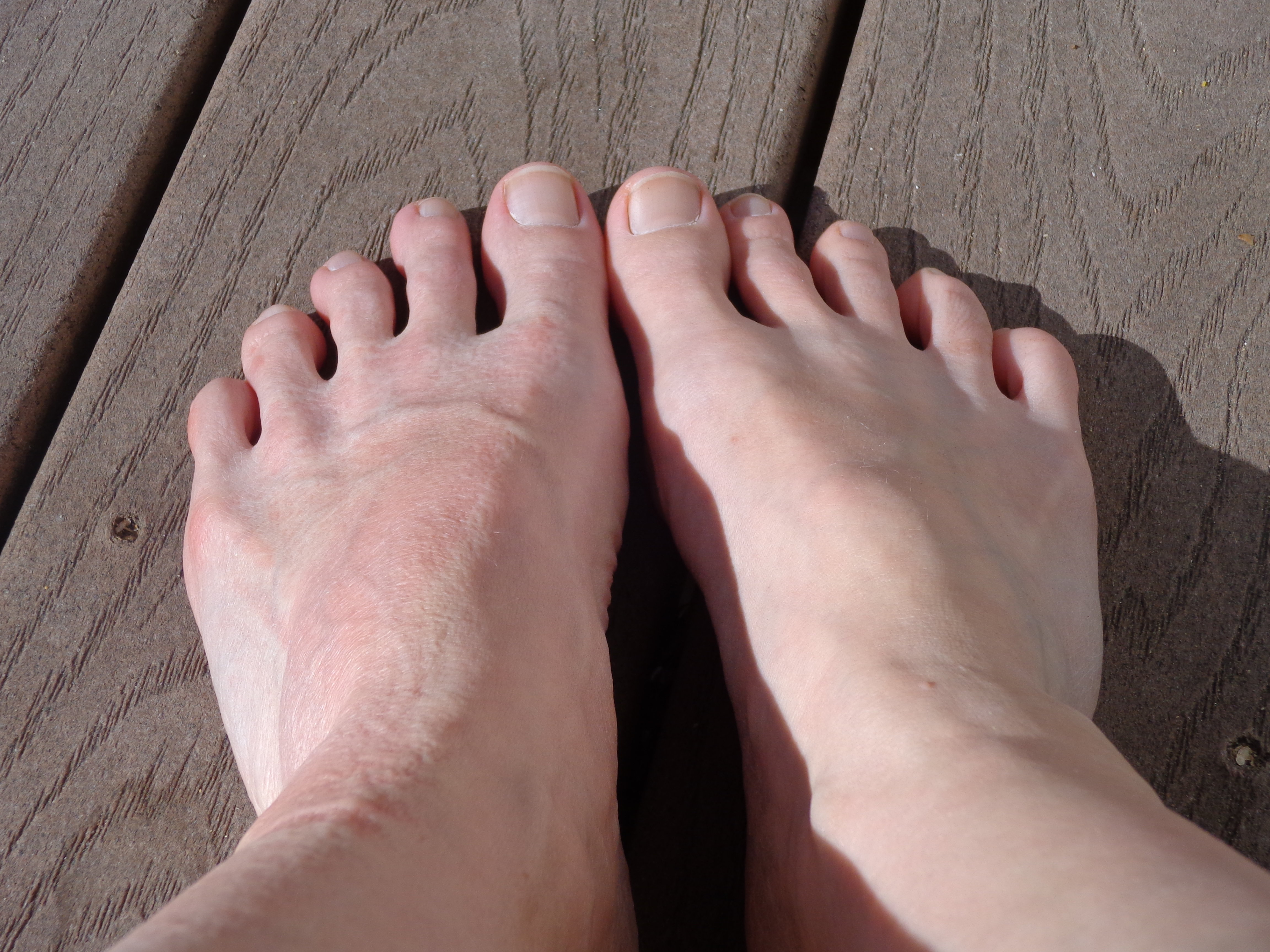 Bare Feet Picture, Free Photograph